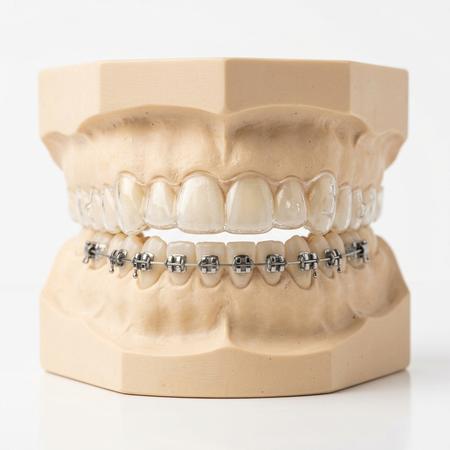 Braces & Aligners